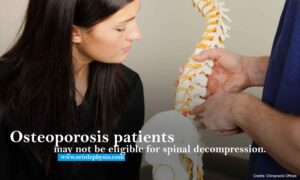 Osteoporosis patients may not be eligible for spinal decompression.