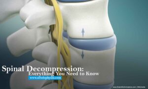 Spinal Decompression: Everything You Need to Know
