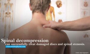 Spinal decompression can successfully treat damaged discs and spinal stenosis.