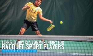 Tennis Elbow is a common injury for racquet-sport players