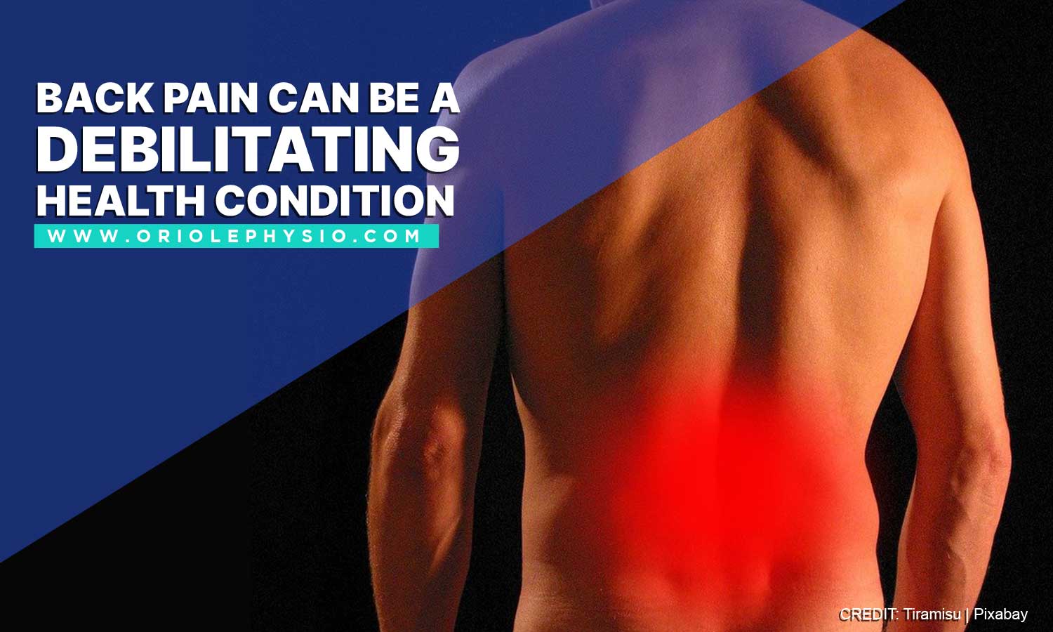 Back pain can be a debilitating health condition