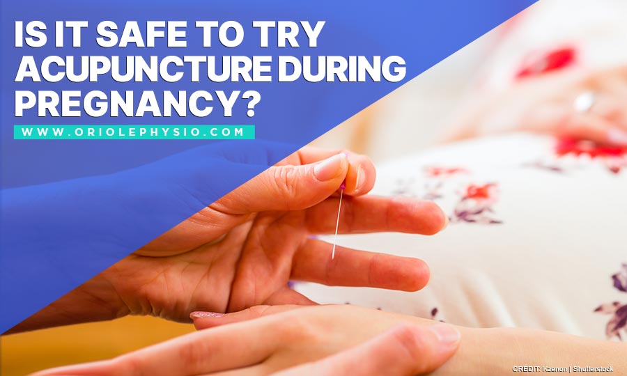 Is It Safe to Try Acupuncture During Pregnancy?