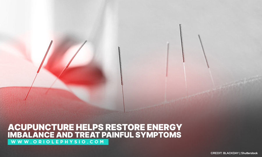 Acupuncture helps restore energy imbalance and treat painful symptoms