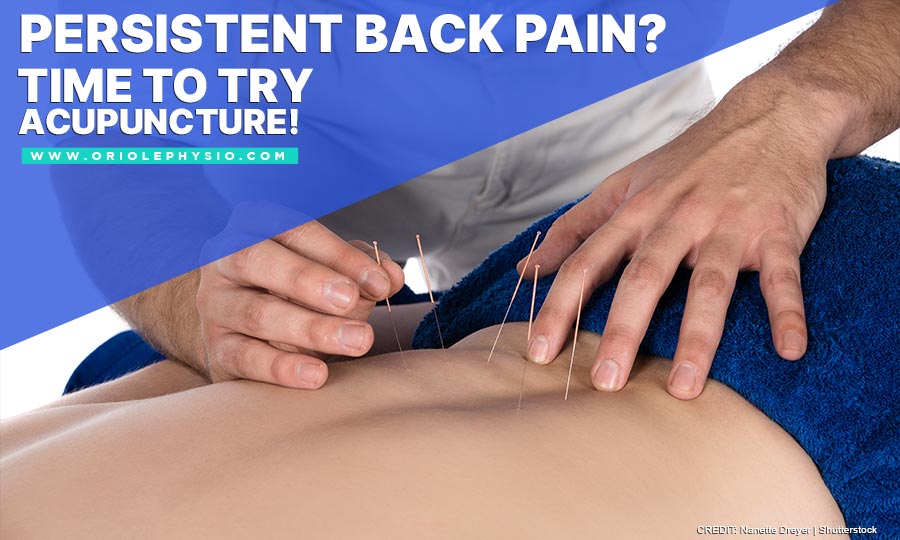 Persistent Back Pain? Time to Try Acupuncture!