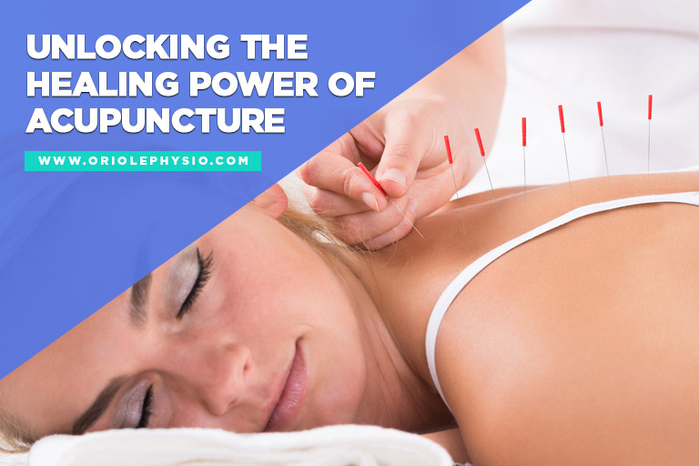 Unlocking the Healing Power of Acupuncture