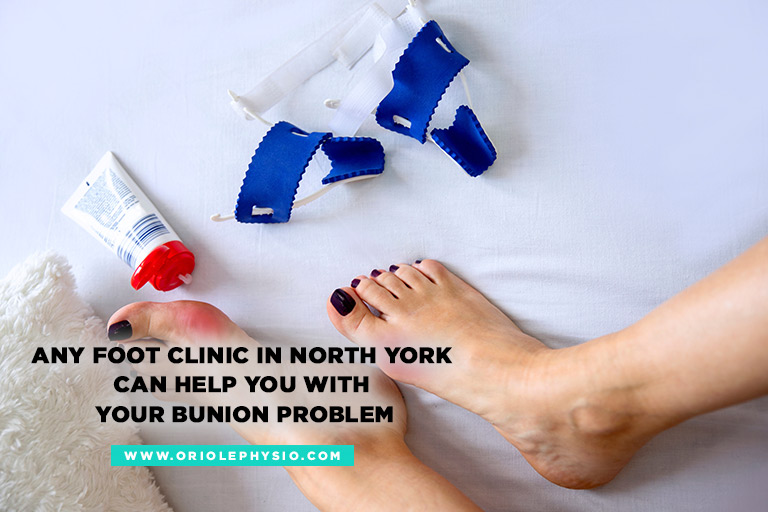 Any foot clinic in North York can help you with your bunion problem