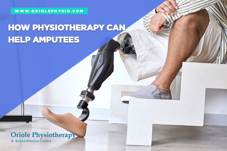 How Physiotherapy Can Help Amputees